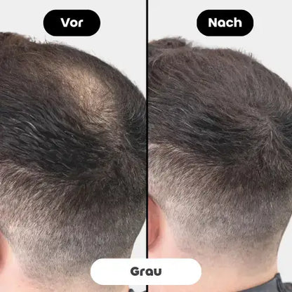 Vorher-Nachher Bild des Fiberhair® Haarpuder Sprays in Grau, das die Calvitie bei feinem Haar effektiv abdeckt und für mehr Dichte und ein natürlicheres Aussehen sorgt.