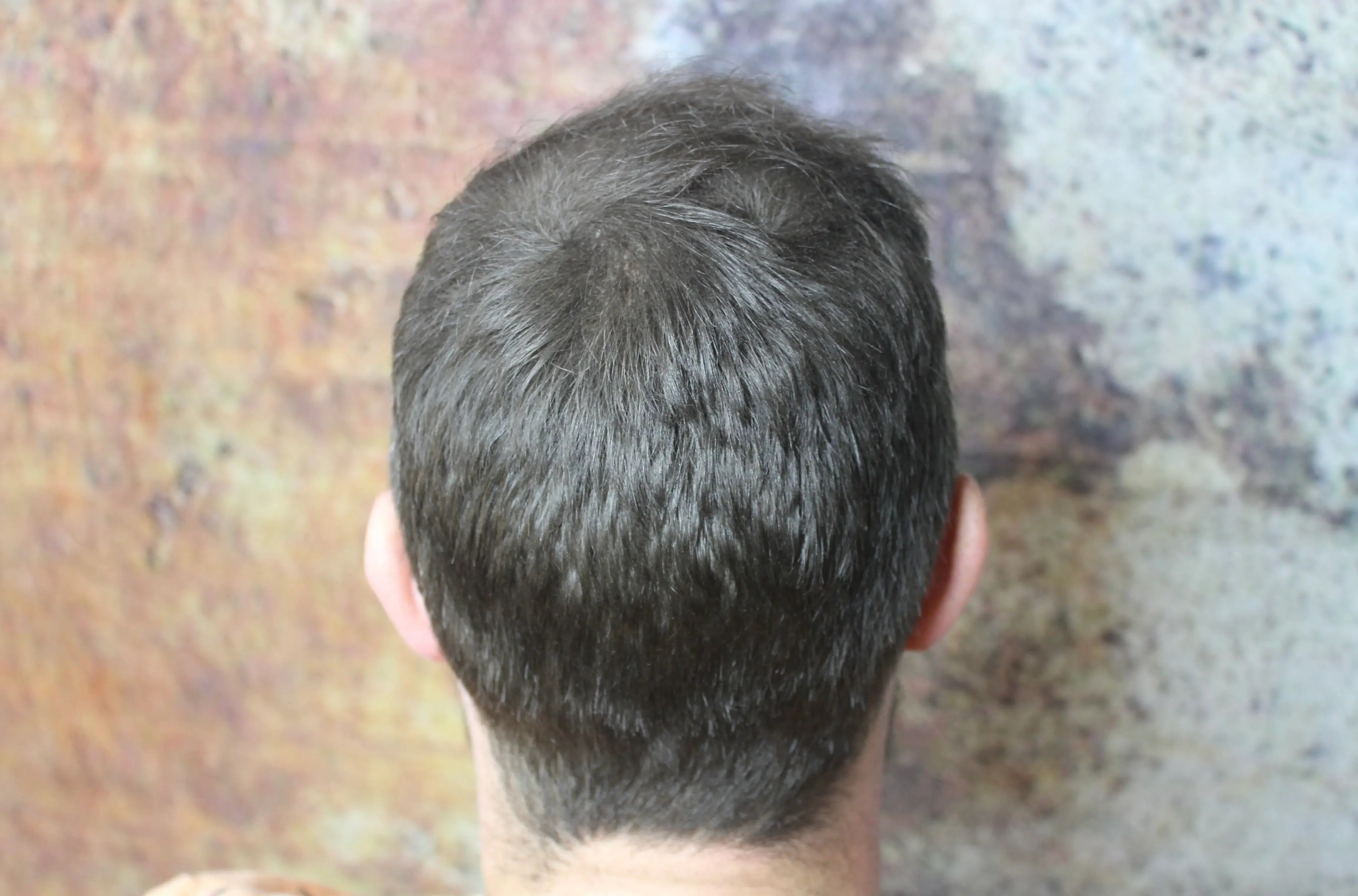 Mann zeigt Haare, die nach der Anwendung des Fiberhair® Haarpuder Sprays mit Keratinfasern sofort die Kahlstellen und dünnen Haare abdecken.