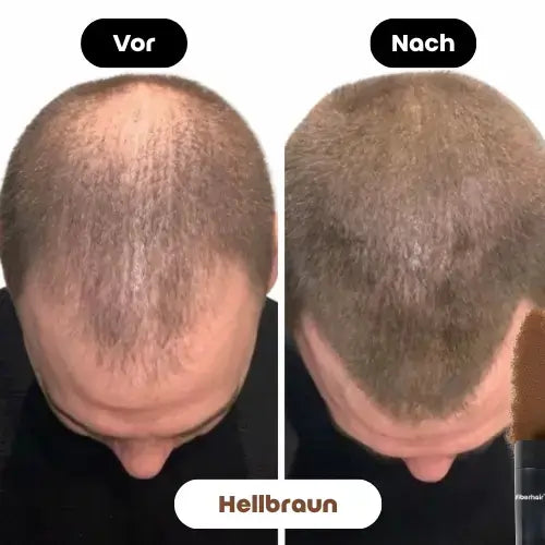 Vorher-Nachher Bild des Fiberhair® Haarpuder Sprays in Hellbraun, das die Calvitie bei kurzen Haaren effektiv abdeckt und für mehr Dichte und ein natürlicheres Aussehen sorgt.