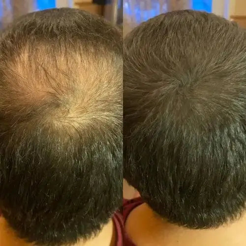 Ich war kurz davor, mir die Haare zu rasieren, aber dieses Pulver funktioniert hervorragend. Ich habe einen jungen Look bekommen!