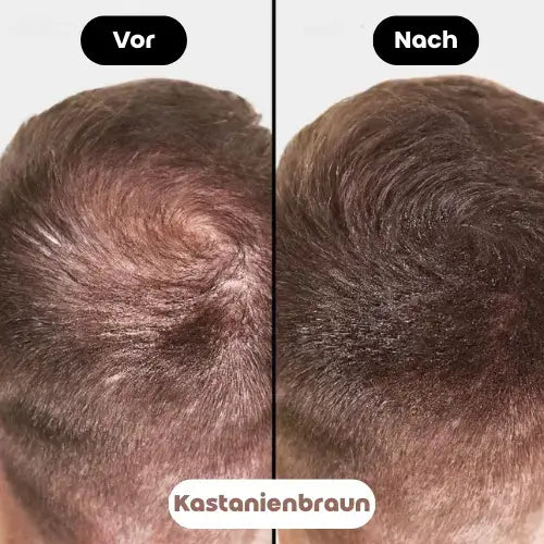 Vorher-Nachher Bild des Fiberhair® Haarpuder Sprays in Kastanienbraun, das die Calvitie bei allen Haartypen von Männern abdeckt und für ein volleres, natürlicheres Aussehen sorgt.
