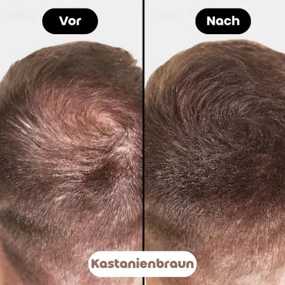 Vorher-Nachher Bild des Fiberhair® Haarpuder Sprays in Kastanienbraun, das die Calvitie bei allen Haartypen von Männern abdeckt und für ein volleres, natürlicheres Aussehen sorgt.