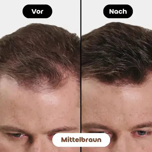 Effektivität des Fiberhair® Haarpuder Sprays in Mittelbraun: Sofortige Abdeckung von dünner werdendem Haar und Calvitie für ein natürlicheres, volleres Aussehen.