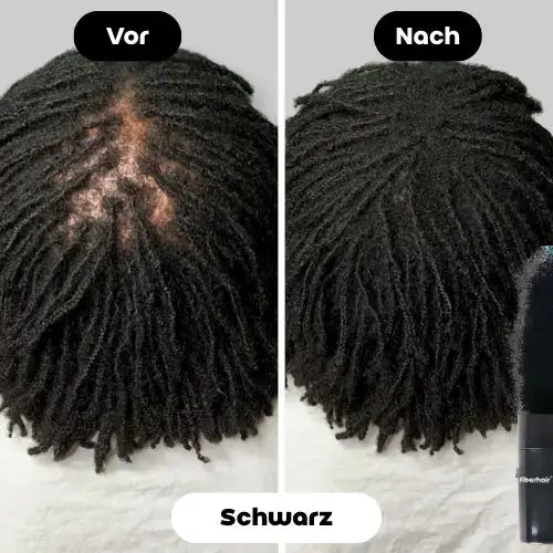 Vorher-Nachher Bild des Fiberhair® Haarpuder Sprays in Schwarz, das die Calvitie bei lockigem Haar von schwarzen Männern effektiv abdeckt und für ein volleres, natürlicheres Aussehen sorgt.
