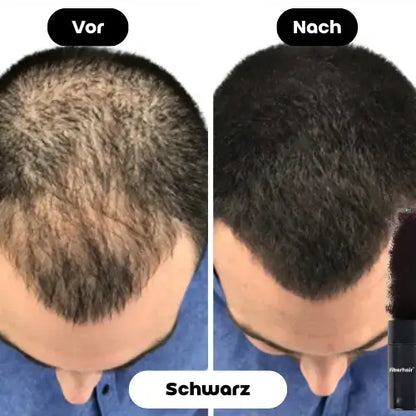 Vorher-Nachher Bild des Fiberhair® Haarpuder Sprays in Schwarz, das in nur 10 Sekunden das Vertrauen zurückgibt und kahle Stellen effektiv kaschiert.