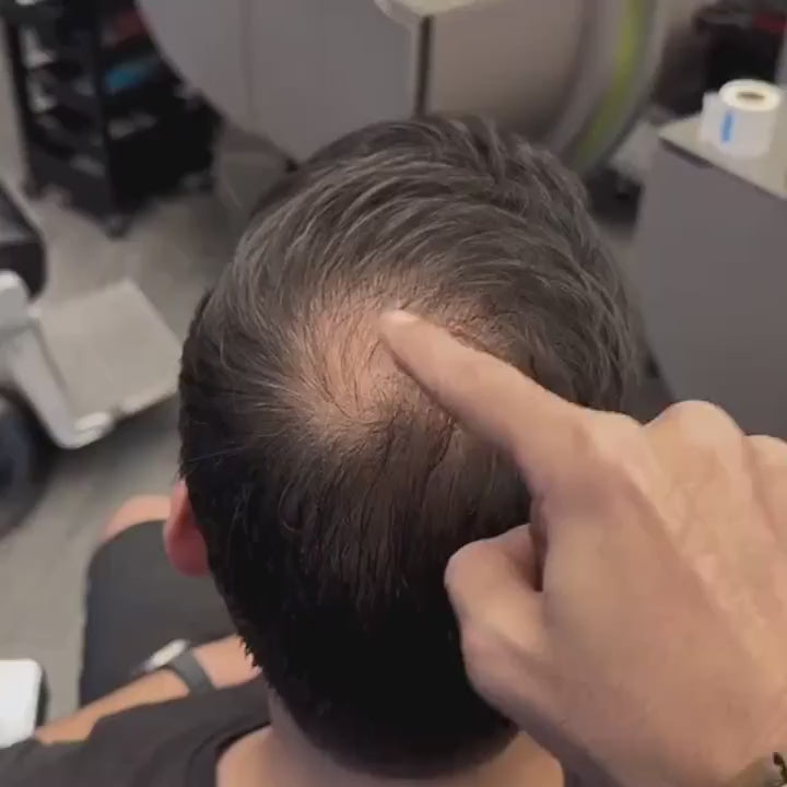 orher-Nachher Video mit dem Fiberhair® Haarpuder Spray, das dünner werdende Stellen abdeckt und das Selbstbewusstsein steigert – für volleres, natürlicher aussehendes Haar.